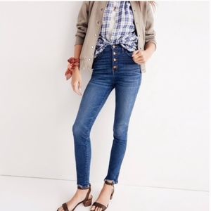 Madewell 9 inch Button Fly Skinny Jeans